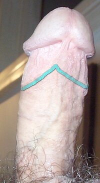 Dcp02512scar.jpg